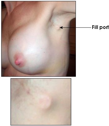 Active Image